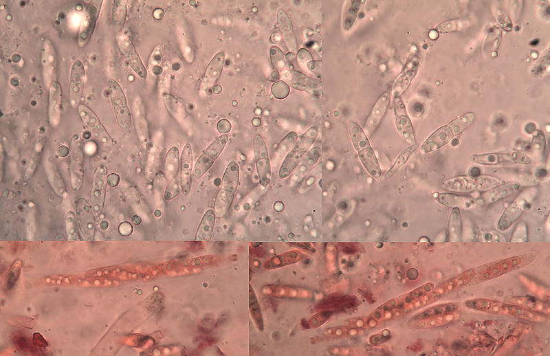 Diaporthe oncostoma micro